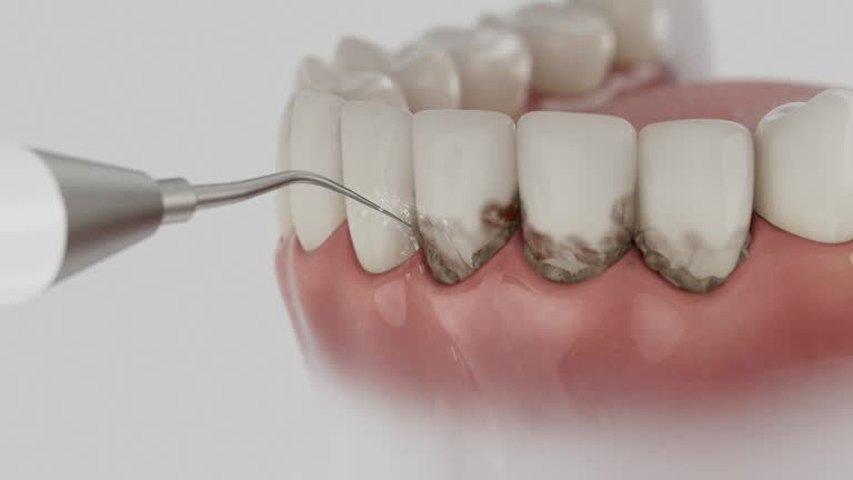 Reliable Dental Implants contractor in Gorman, NC by Smile Center Dentistry